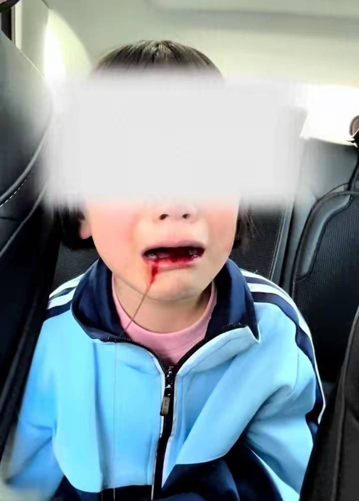 7岁女孩被8名男孩霸凌,网传其父亲净身出户,并练拳击与枪法