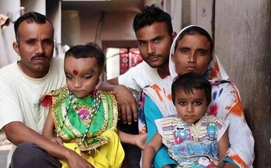 原创印度8岁男孩脑袋形似漏斗,被人奉为象头神,医生:恒河水造成的