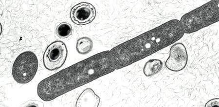 炭疽杆菌100倍油镜图片图片