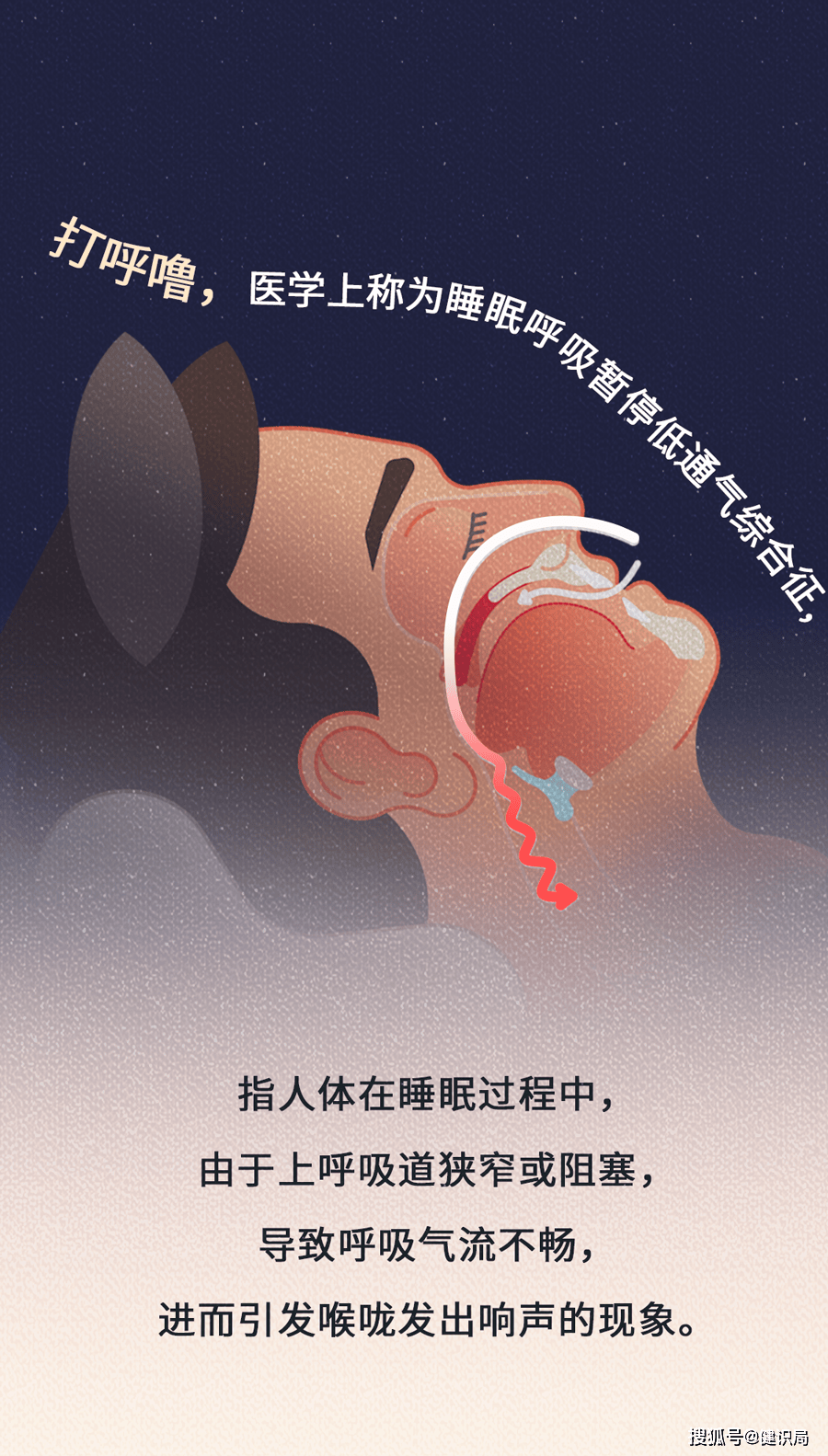 人为什么打鼾呢怎么回事为什么在线 人为什么打鼾呢怎么回事为什么在线