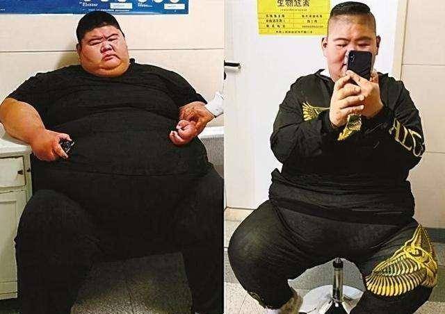 王浩楠:切掉五分之四胃后,一年廋三百斤并收获了真爱_减肥_体重_成功