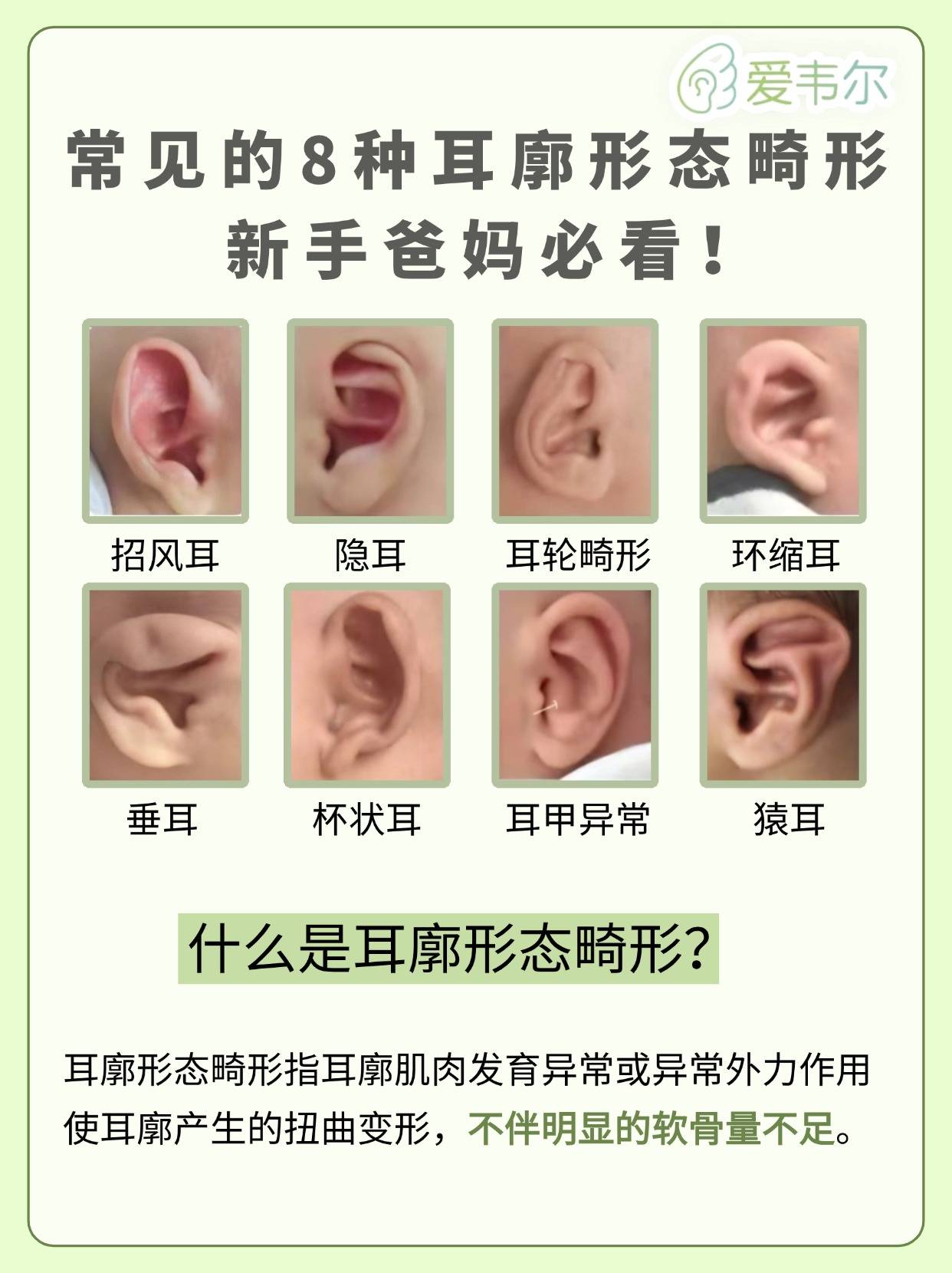 常见的8种耳廓形态畸形新手爸妈必看