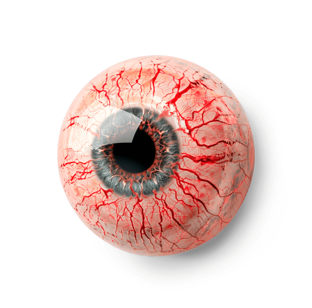 红眼病进入高发期速看防护指南