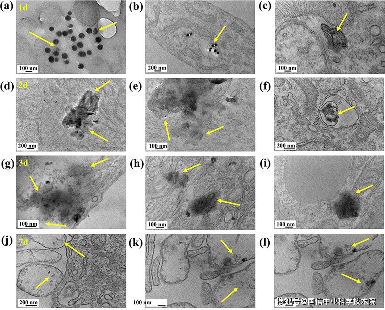 生物透射电子显微镜(TEM):实验结果_细胞_研究_结构
