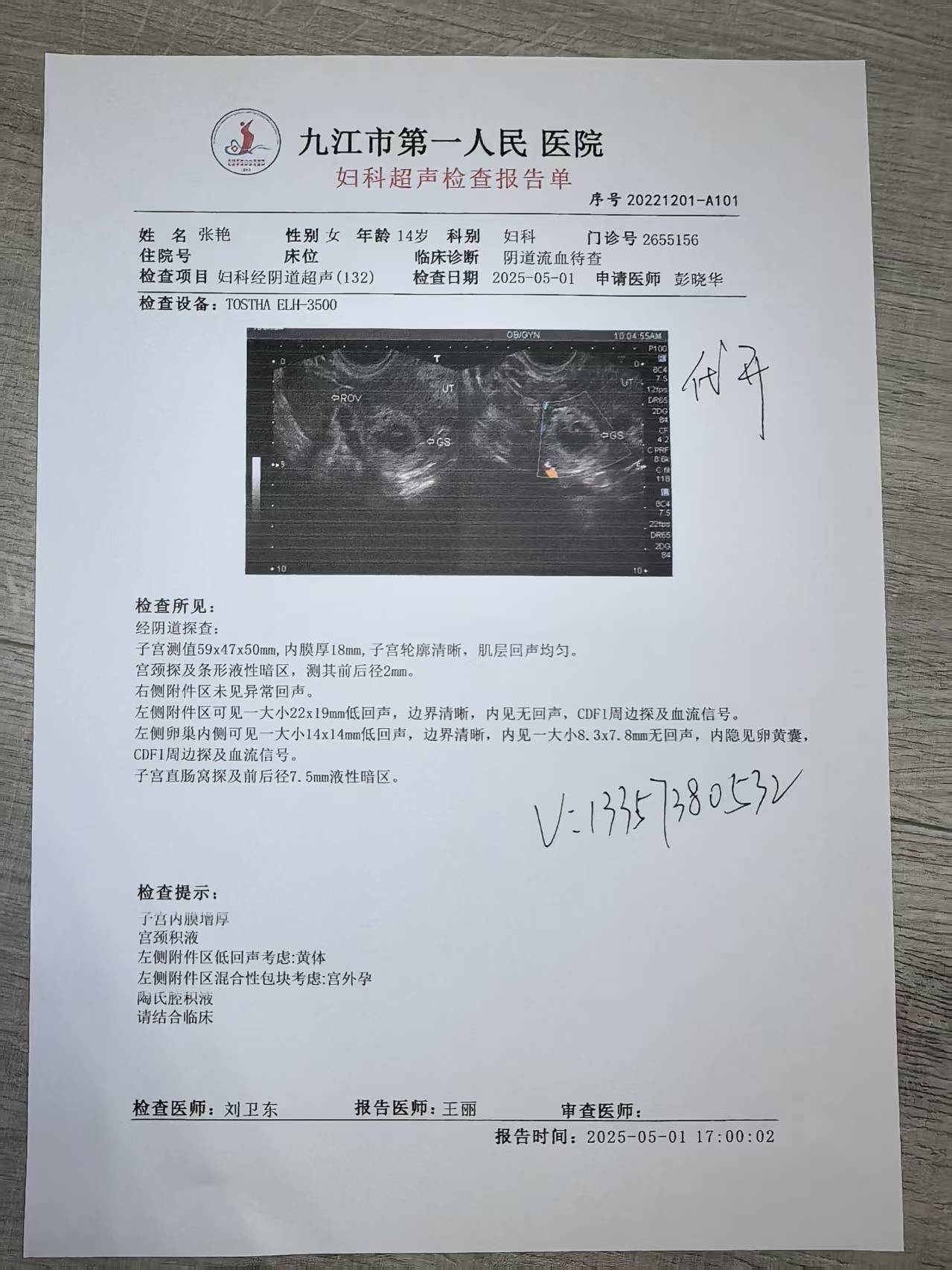 一键生成假怀孕b超单