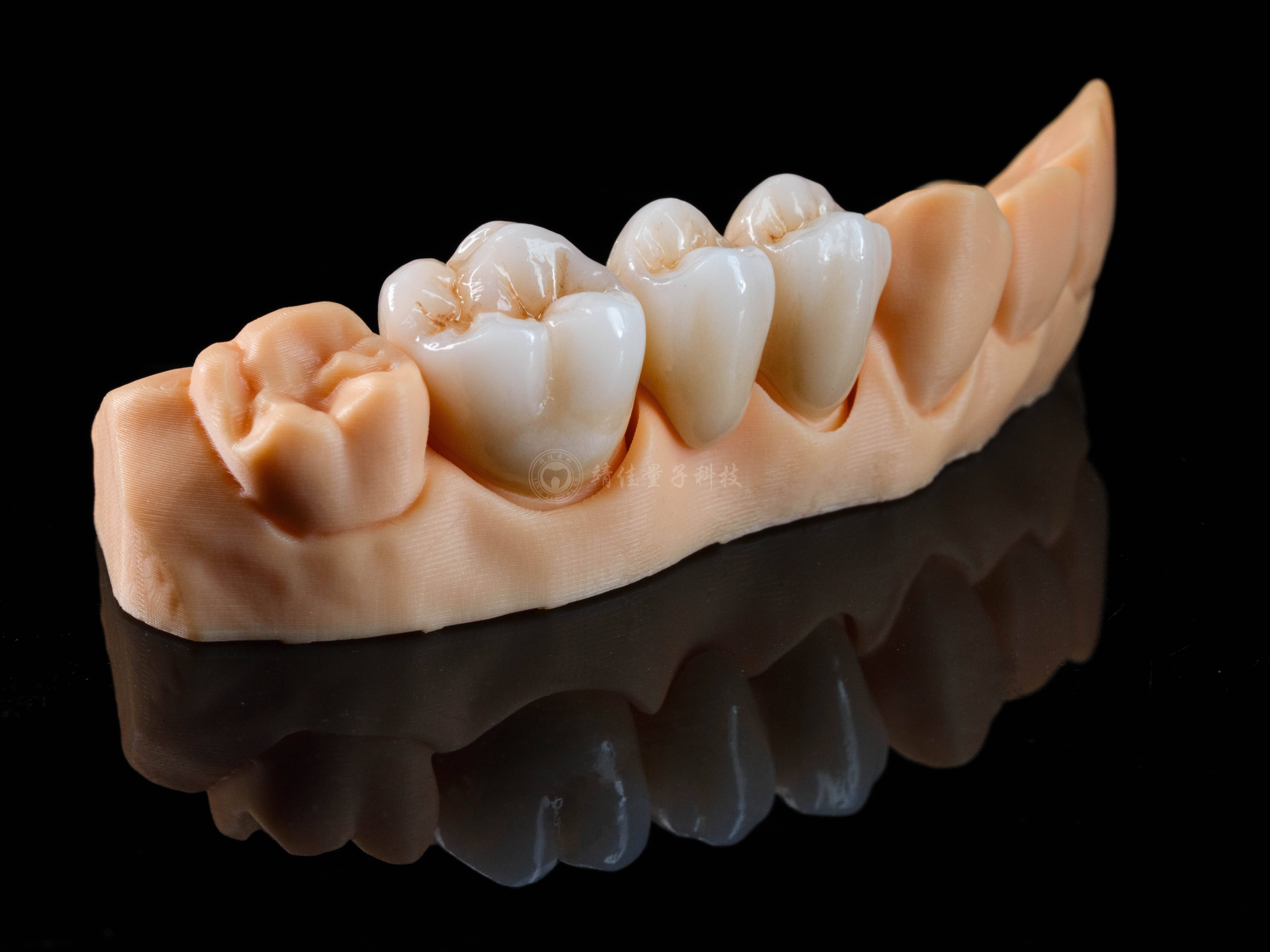 义齿固定桥修复的生理基础及生物力学分析