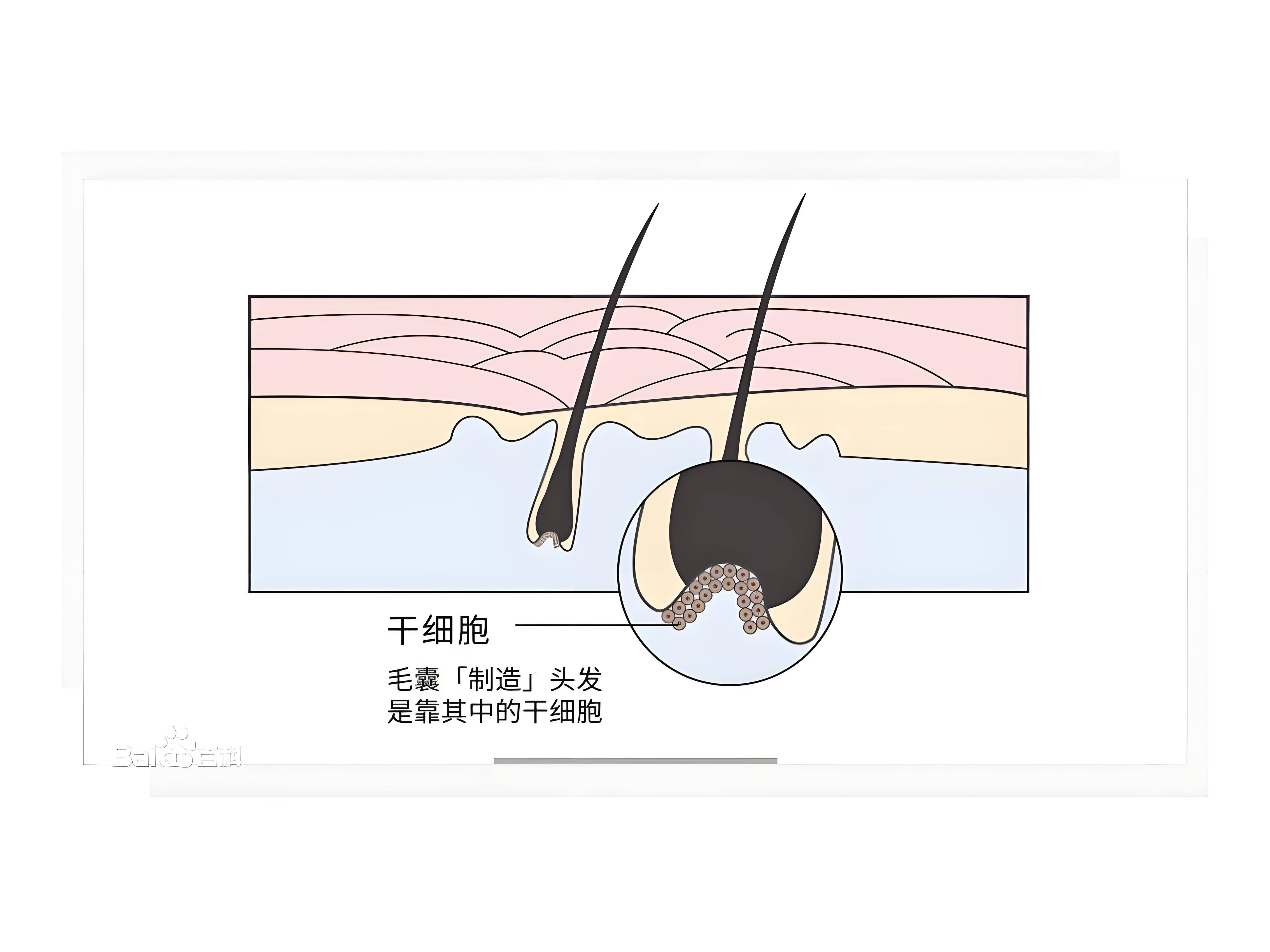 干细胞生发?真假毛囊克隆的真相与前沿