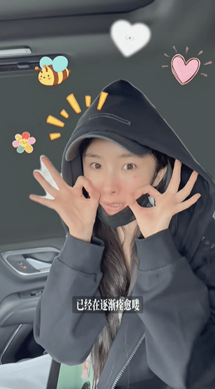 杨幂烫伤后素颜出镜称正在痊愈 容颜精致气色依旧在线