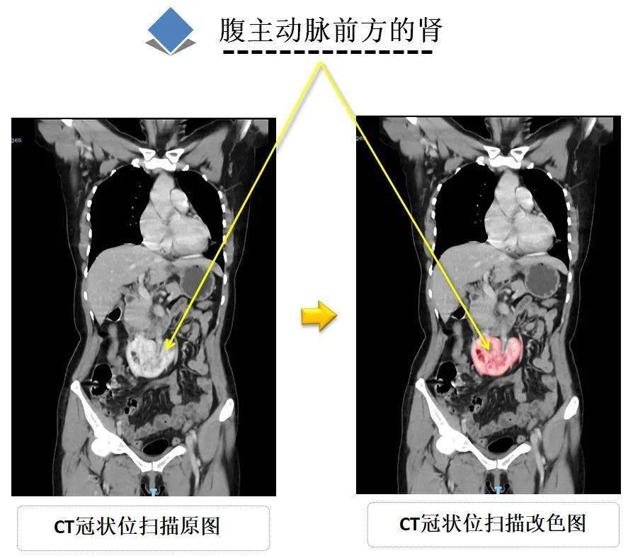 x 射線,ct,mri 等)獲取人體內部結構的圖像,並結合解剖學知識對這些