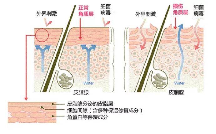 皮膚失去皮脂膜的保護,就容易出現乾燥,瘙癢等症狀