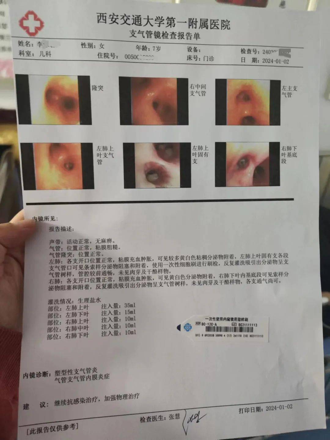 医生把支气管镜的报告给了我,可以清晰看到妹妹的肺部有很多顽固的痰