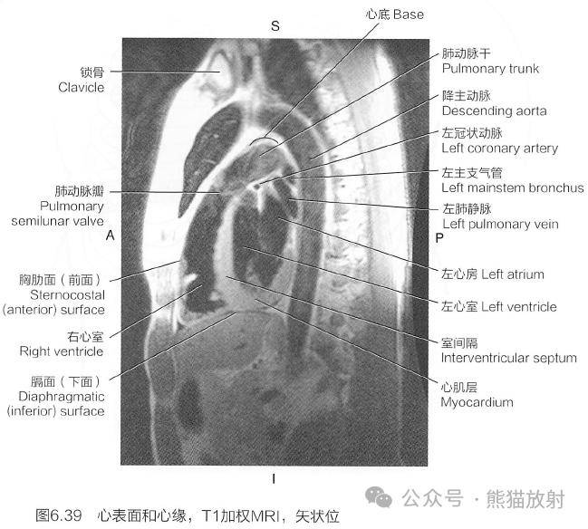 斷解選讀丨心臟及大血管~_動脈_系統_解剖