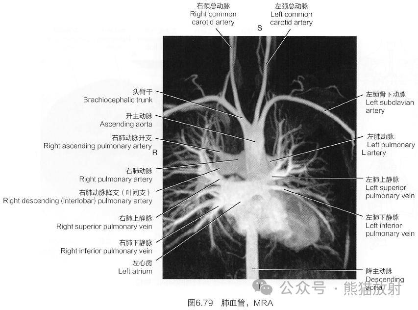 斷解選讀丨心臟及大血管~_動脈_系統_解剖
