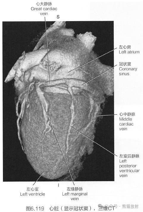 斷解選讀丨冠狀動脈_全網_影像_解剖圖