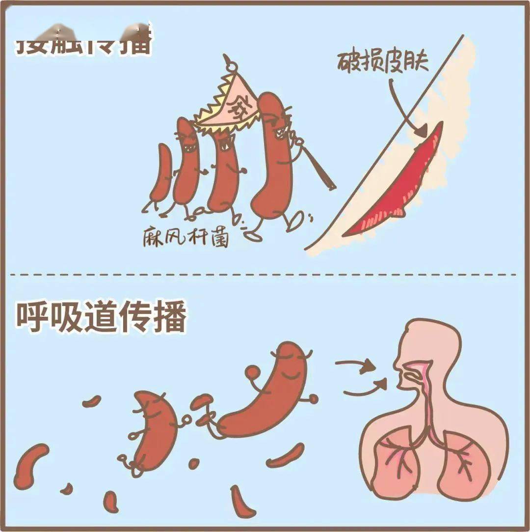 它的主要传播方式:麻风病是如何传染的麻风病是由麻风分枝杆菌引起的