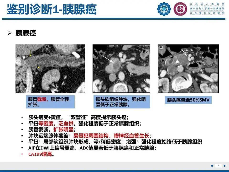 局灶型自身免疫性胰腺炎——談