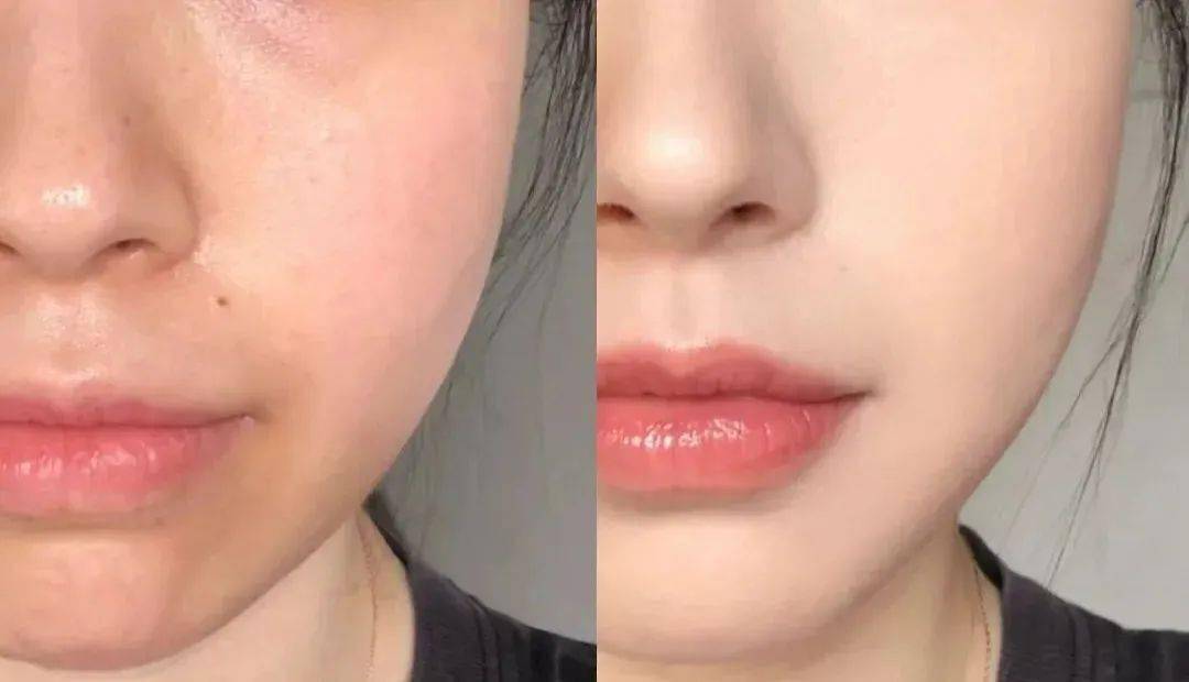 亲测上脸效果图75(*个人测试,以实际为准,仅供参考)遮瑕力也很强