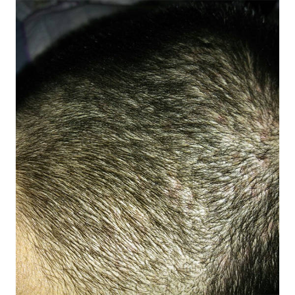 去头屑洗发水排名