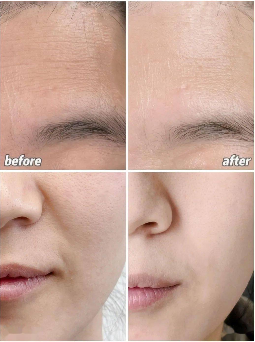 过年熬成"焦黄脸",该怎么救?