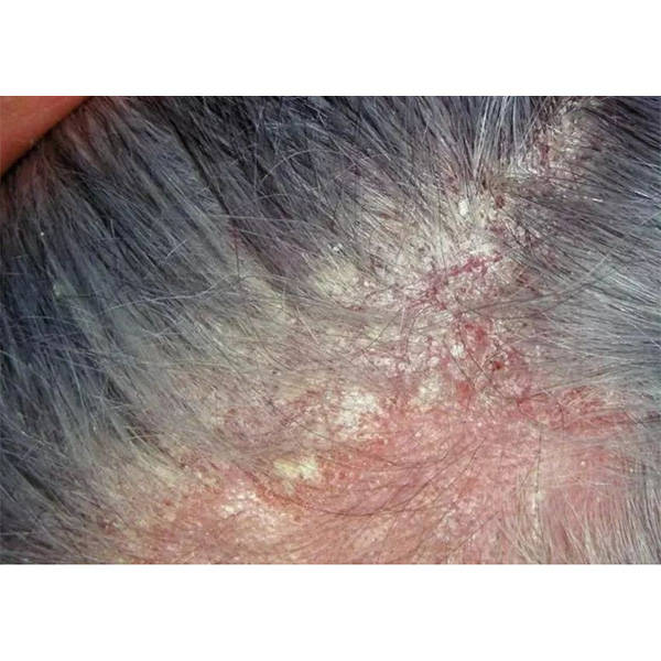 氨基酸去屑控油洗发水推荐