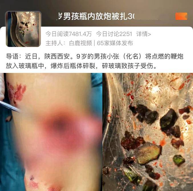 千万不要这样放炮_鞭炮_眼睛_皮肤