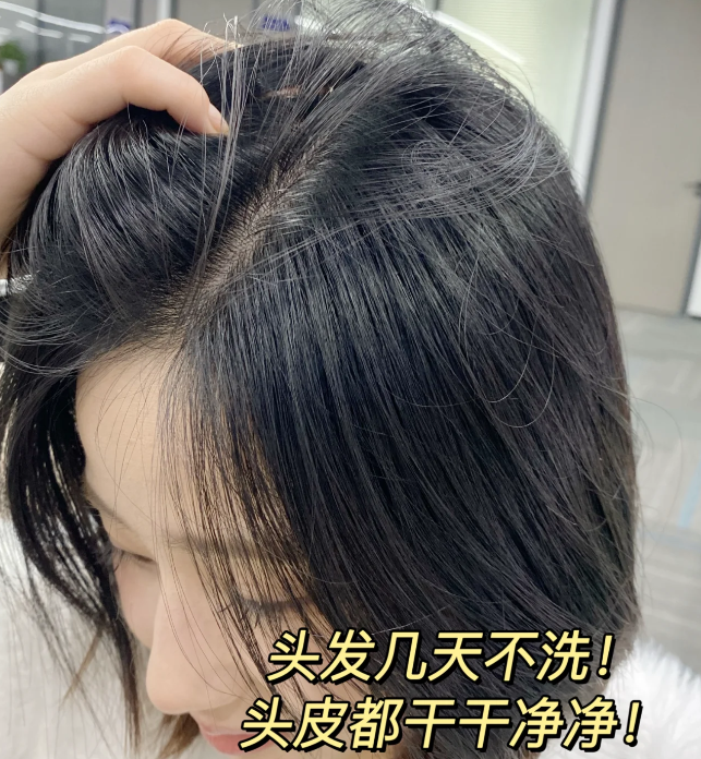 去屑又养头皮的洗发水推荐_头发_问题_成分