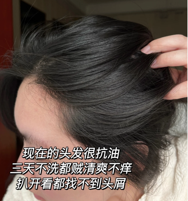 十芳清去屑止痒控油洗发水是一款专业的去屑产品,它以其独特的配方和