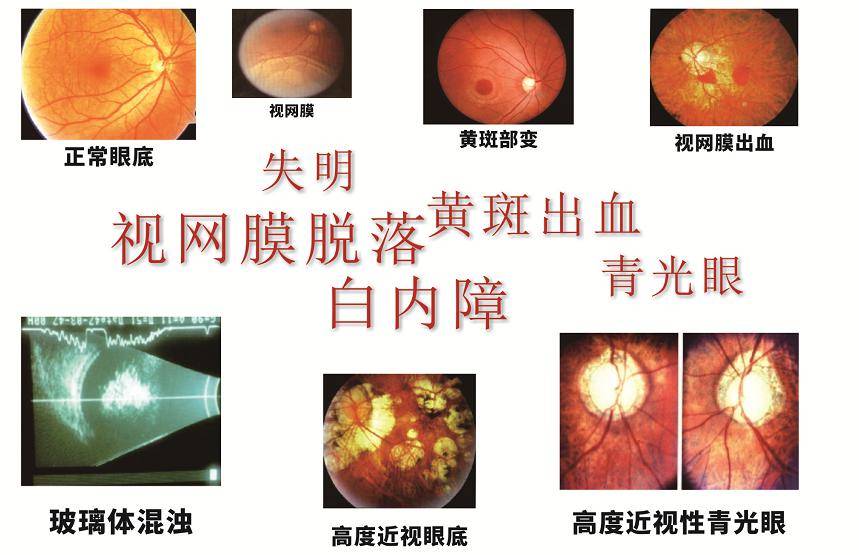 是不是再交智商税?_防控_眼底_相关