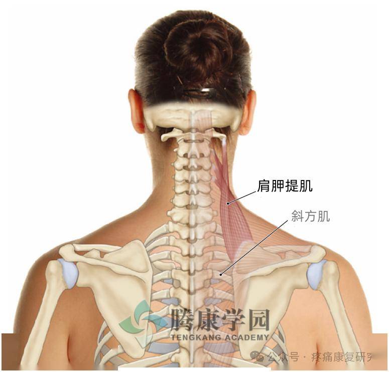 肩胛骨上角顽固性疼痛,最可能与这块肌肉有关_按摩_患者_触发