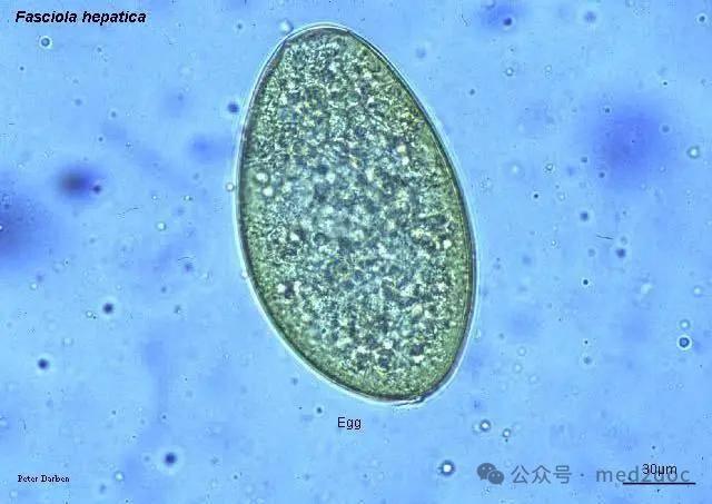 听到兰阿姨的回答,黄琴终于豁然开朗:"水芹菜等水生植物是肝片形吸虫