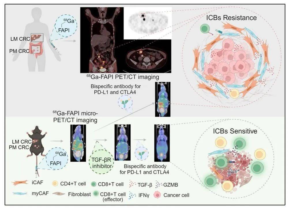 复旦大学唐爽/宋少莉团队发现68ga-fapi pet/ct指导下的靶向tgfβ联合