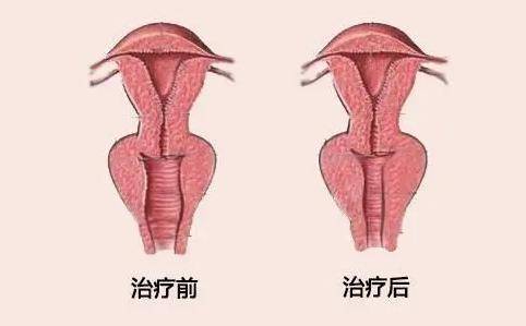 球海绵体肌锻炼图图片