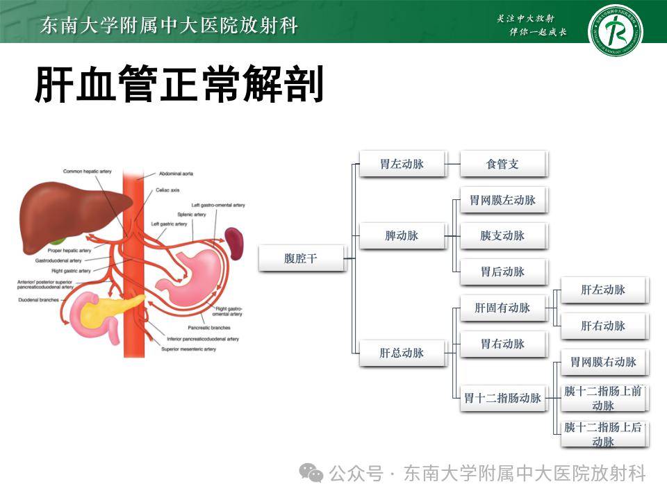 肝血管畸形图片