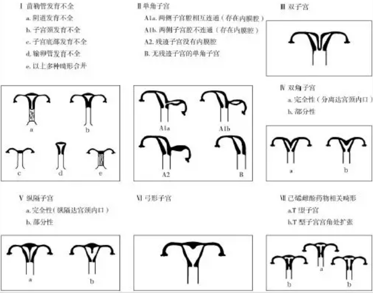 双子宫位置图片图片