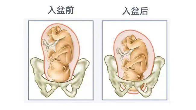胎儿b超图详解图片