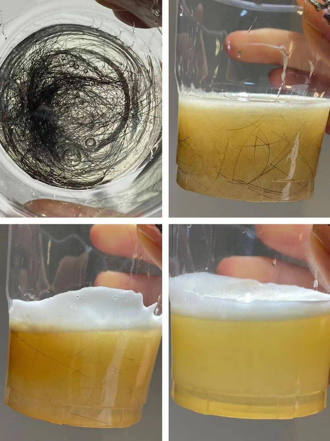 陈年油垢,毛发"嗖"的一下都通了,小飞虫也不来了!