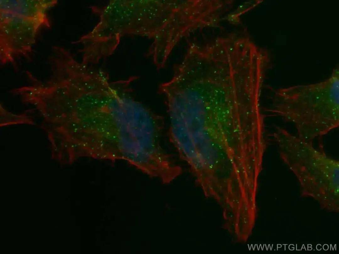 marker_蛋白_高尔基体