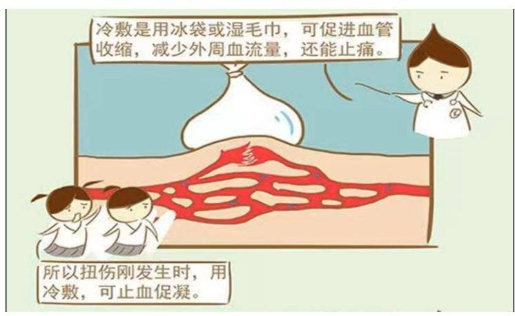 原创科普丨运动扭伤后,到底要冷敷还是热敷?小心伤上加伤!