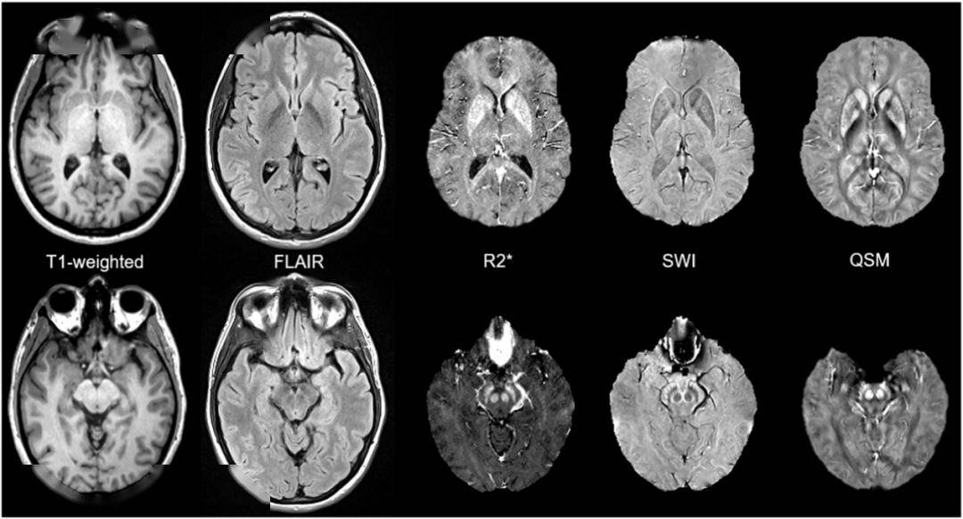 科研速递 | 张敏鸣教授团队联合多国学者发表综述:推