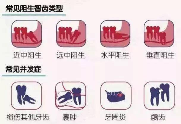 拔智齿的绝佳年龄,希望你不再错过!_牙齿_口腔_清洁