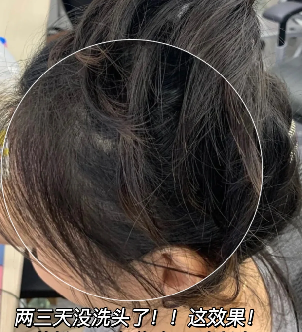 头发_头皮屑_成分