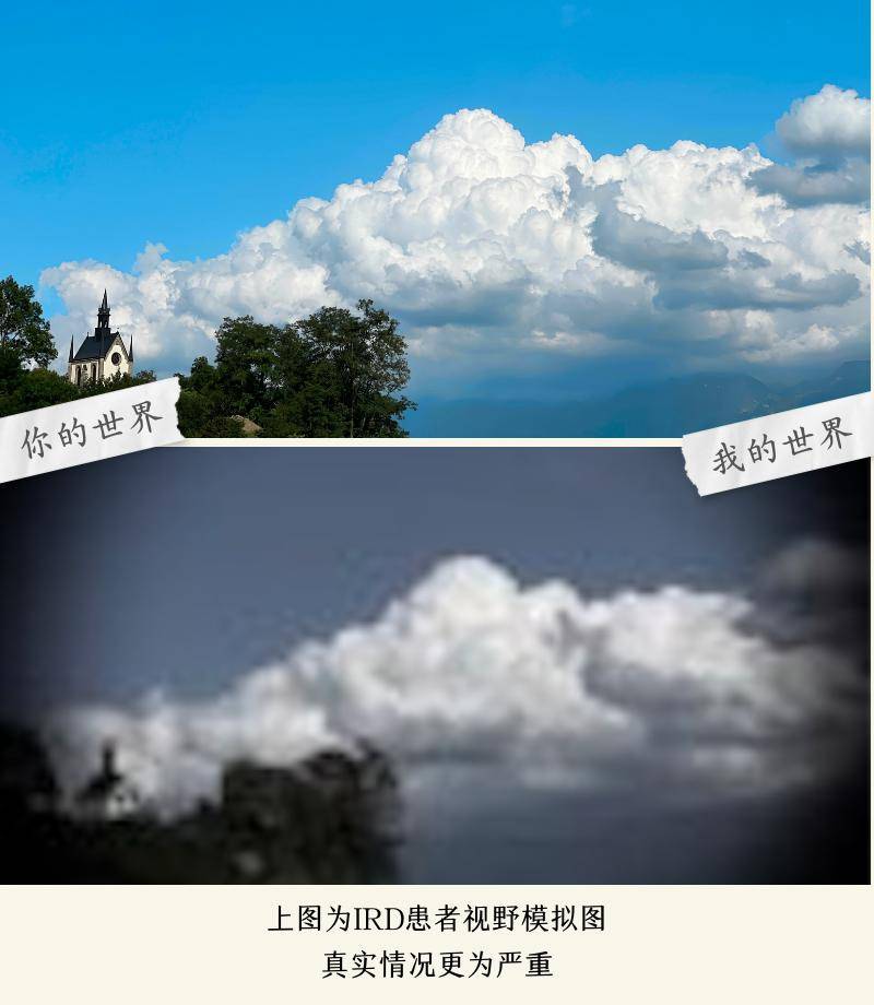 爱不罕见 | 看不清阴天晴天,却能看到爱与温暖