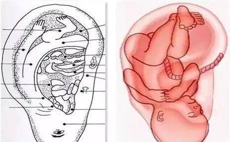 神奇的耳穴療法,降壓止痛治失眠_按摩_耳窩_耳朵