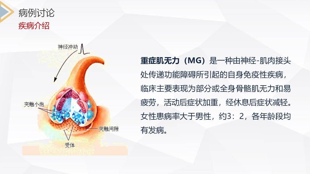 【ppt】重症肌无力(Ⅲ型)护理查房_直播_文库_来源