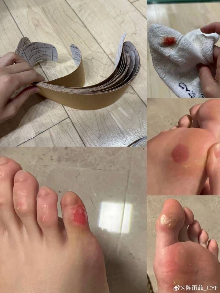 陈雨菲迎26岁生日,发文称脚伤已好,满意近期训练情况:无名小卒陈某菲