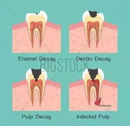 食物_牙齿_组织