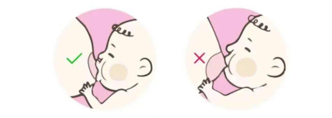 1,吸吮大部分乳晕:宝宝吸吮时,妈妈应该看不到乳头的底部,只能看到