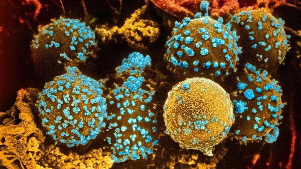 经济学人 ||1型糖尿病的新治疗方法正在出现_the_cells_islets