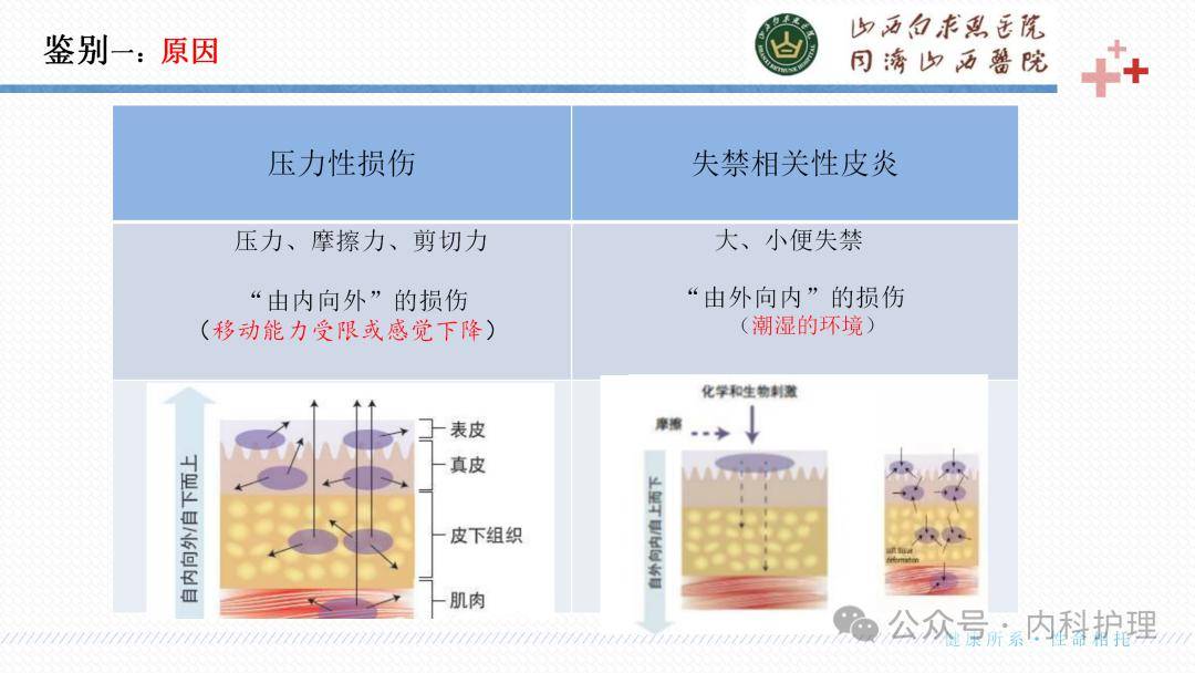 【ppt】成人失禁相关性皮炎的识别与护理_患者_治疗_临床