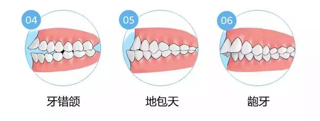 为什么越来越多的人做牙齿矫正